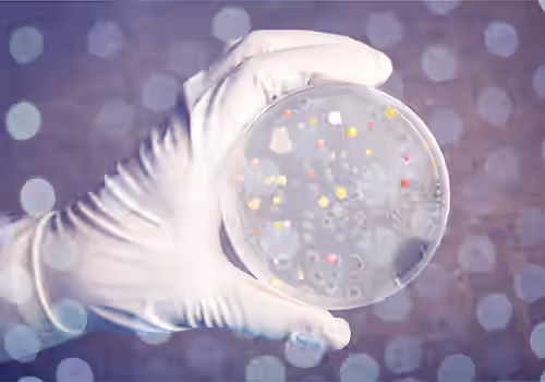 gloved hand holding petri dish with cultures. What is Anthrax?